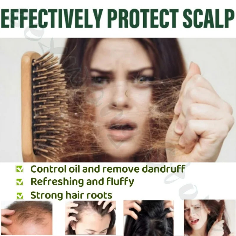 Seven Green Orchidaceae Leaf Usman Shampoo Safeguard Scalp Soothing Hair Follicles Balance Oil Improves Rough Hair Quality 120g